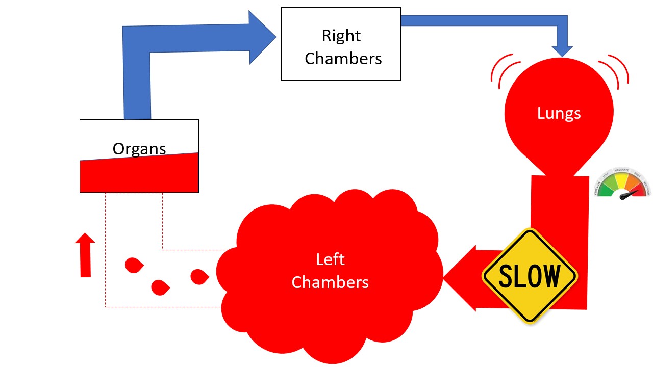 Figure 3: Deconstructed consequences of left chamber pump failure