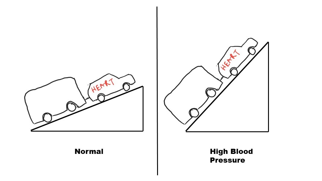 Figure 2:  As the blood pressure increases, the uphill task on the heart increases. 