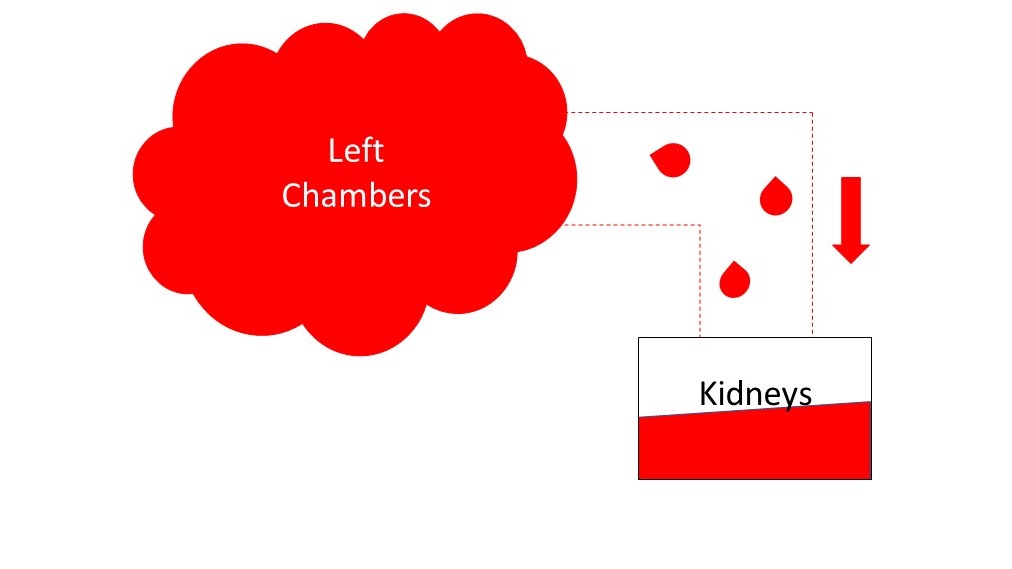 Figure 2: Weak heart pump is unable to pump enough blood to kidneys which perceive the body as 'dry'.