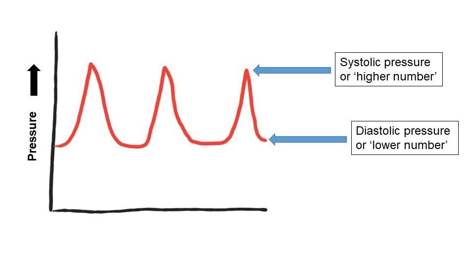 Figure 1: Pressure rises within the arteries with each heart beat, called the systolic pressure. 